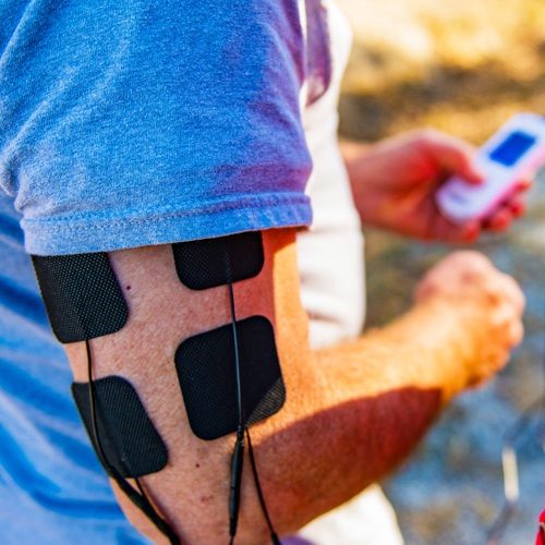 Small iReliev TENS EMS Pads shown in use on the tricep to relieve muscle inflammation
