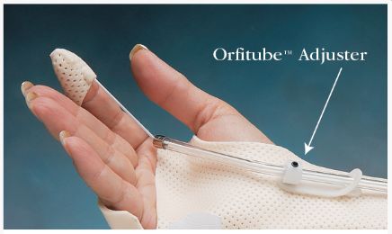 Orfitube Adjusters for Splints, 5 Pack