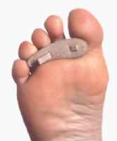 Hammer Toe Crests, Pack of Three