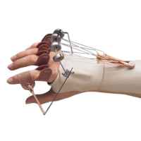 Phoenix Outrigger Kit For Radial Nerve Damage from North Coast Medical
