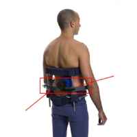 D.B.S. Dynamic Brace System for Scoliosis