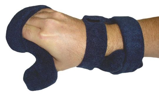 Top view of the Comfy Splints Deviation Opposition Hand Orthosis