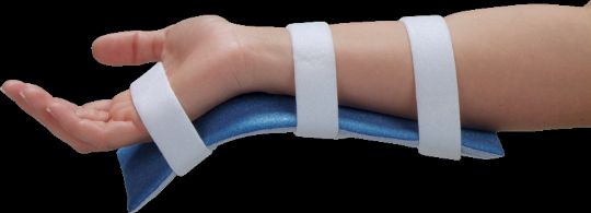 Helps keep the arm immobilized during IV therapy