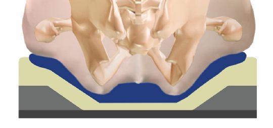The pelvic loading are was determined by actual user's skeletal measurements to ensure comfort