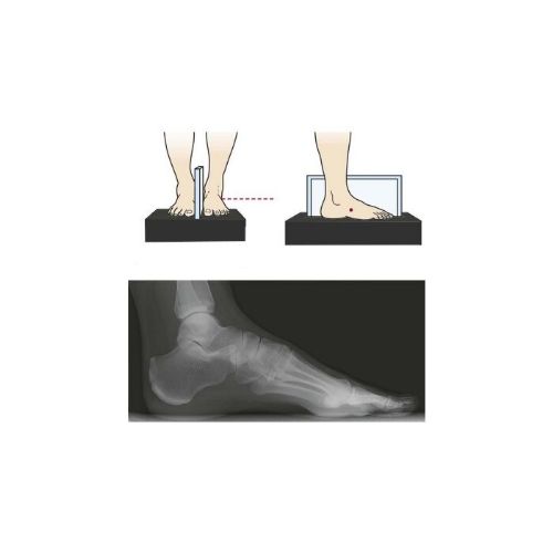 Facilitates precise imaging of longitudinal arch and lateral projection studies of feet and ankles, aiding in accurate diagnosis and treatment planning
