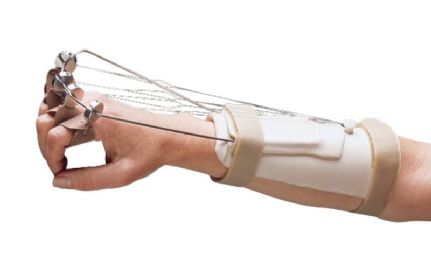 Phoenix Extended Outrigger Kit - Radial Nerve Splint from North Coast