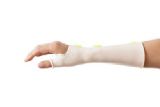 Splinting Thermoplastics