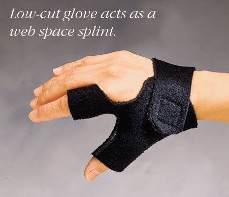 The glove of the arm splint acts as a web space splint.