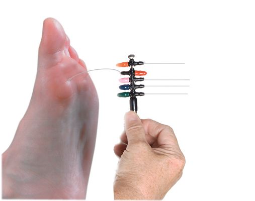 Weinstein Enhanced Sensory Test (WEST) Monofilaments for Foot Evaluations