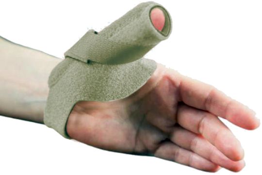 Adult Thumb Spica Splint with Dorsal Stay by McKie Splints