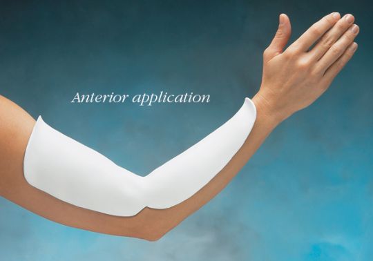 Elbow Pre-Cut Splint in anterior application