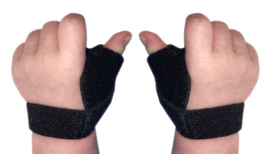 Neonatal Thumb Splints by McKie Splints