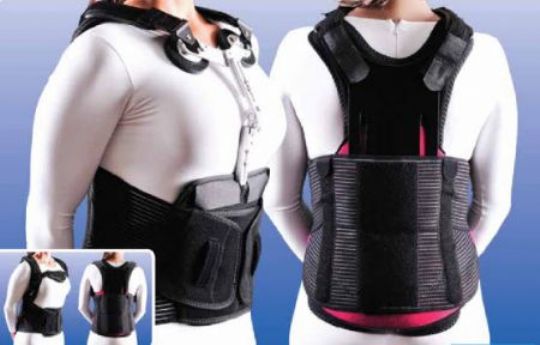 Evotec TLSO with PPX and Dorsal Lumbar Kit