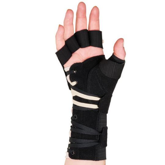 Radials Finger Support For Radial Nerve Paresis - Back View of the Right Hand