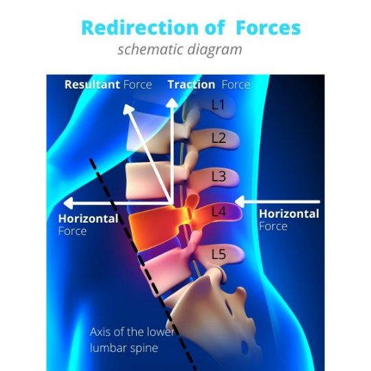 Here's how the Lumbar Decompression works