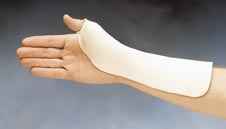 Radial Based Thumb Spica Splint