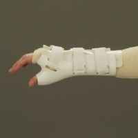 Hand Thumb Fracture Bracing
