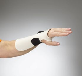 Wisconsin Radial Bar Immobilization Orthosis For Wrist and Forearm Use by Manosplint