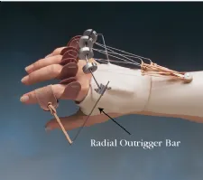 Discount Outrigger Splints and Splinting Accessories