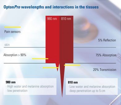 Optonpro High Power Laser Therapy System